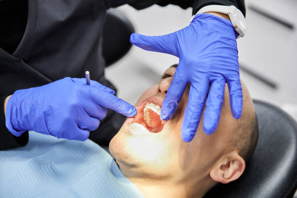 Best Emergency Wisdom Teeth Removal in Broken Bow, NE